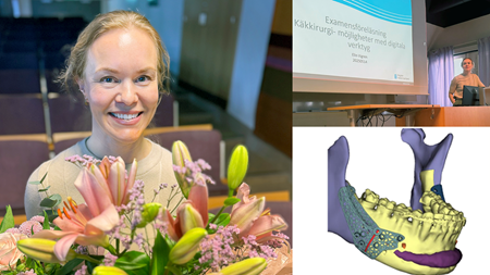 Tredelad bild med först käkkirurgen Elin Vigren med blommor i famnen, sen en bild från examensföreläsningen samt en digital bild på en underkäke.