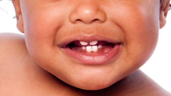 Närbild på spädbarns mun, fyra tänder visas i ett skratt